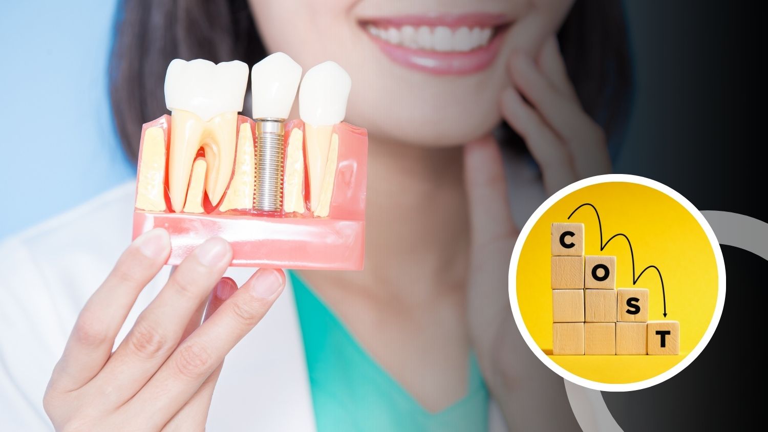 Dental Implant Cost in Madurai