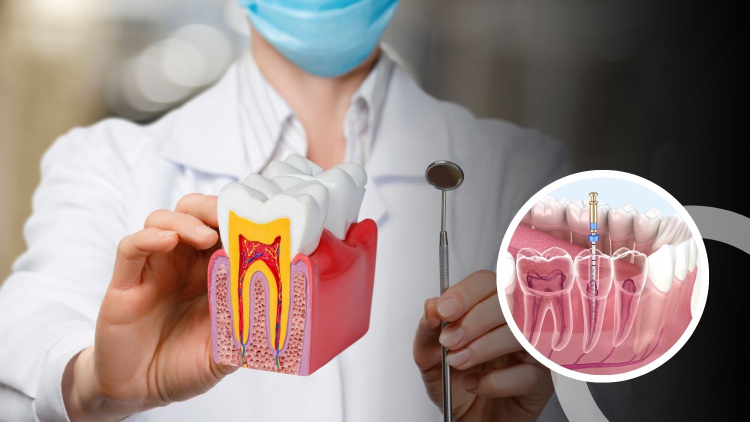 Tooth Cleaning in Madurai