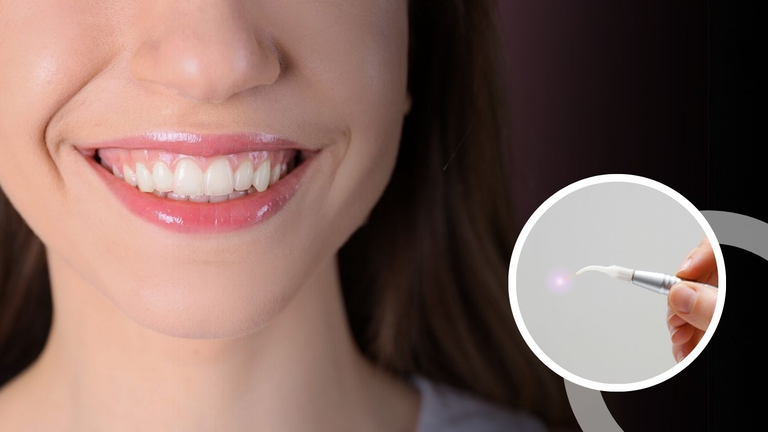Dental Crown and Bridge Treatment in Madurai