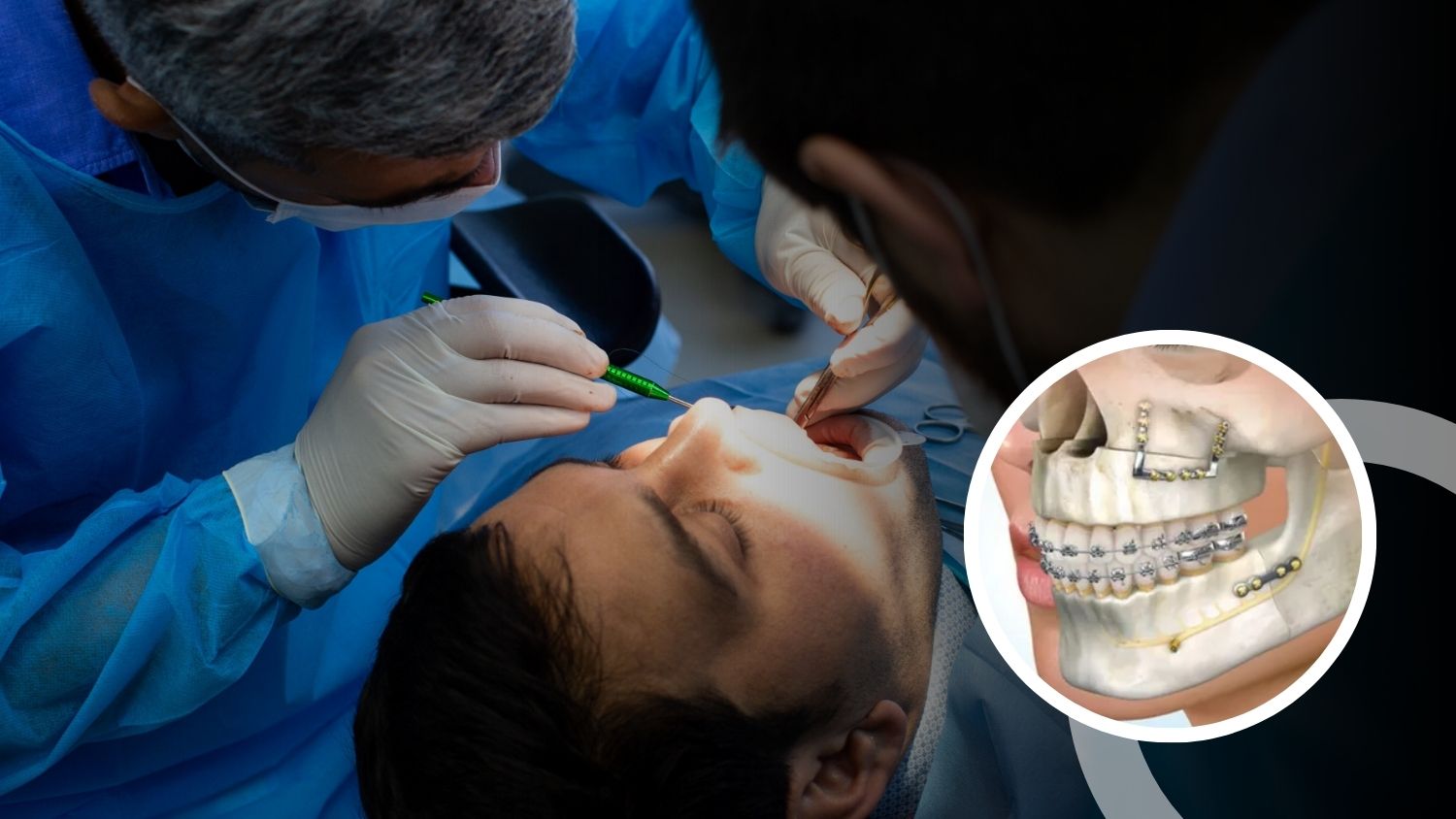 Oral Surgery in Madurai