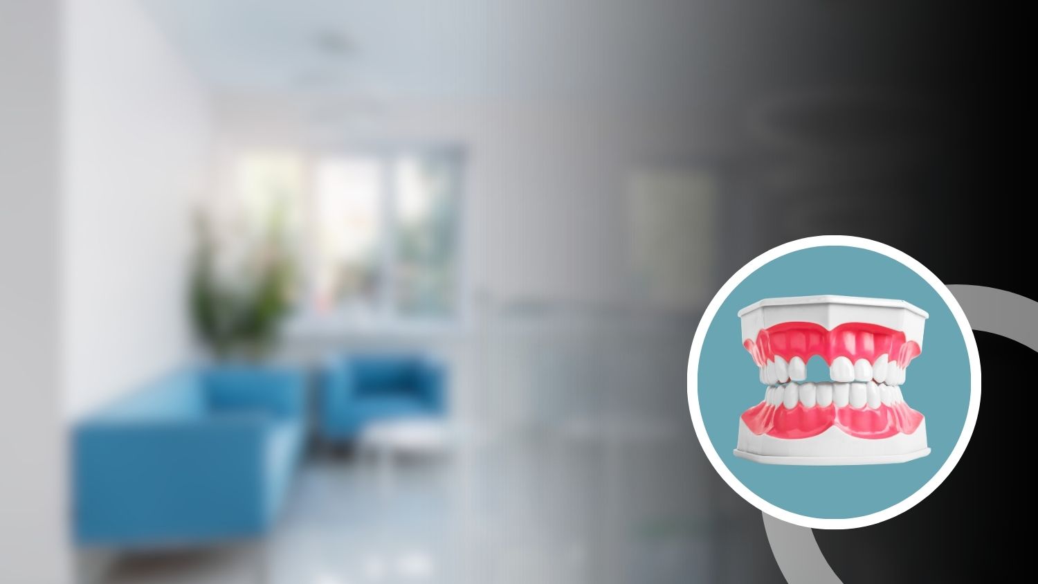 Teeth Replacement Treatment in Madurai