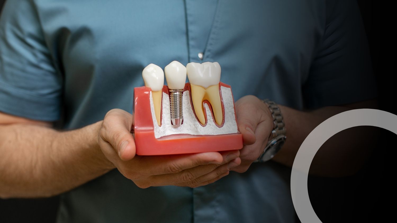 Tooth Implant in Madurai