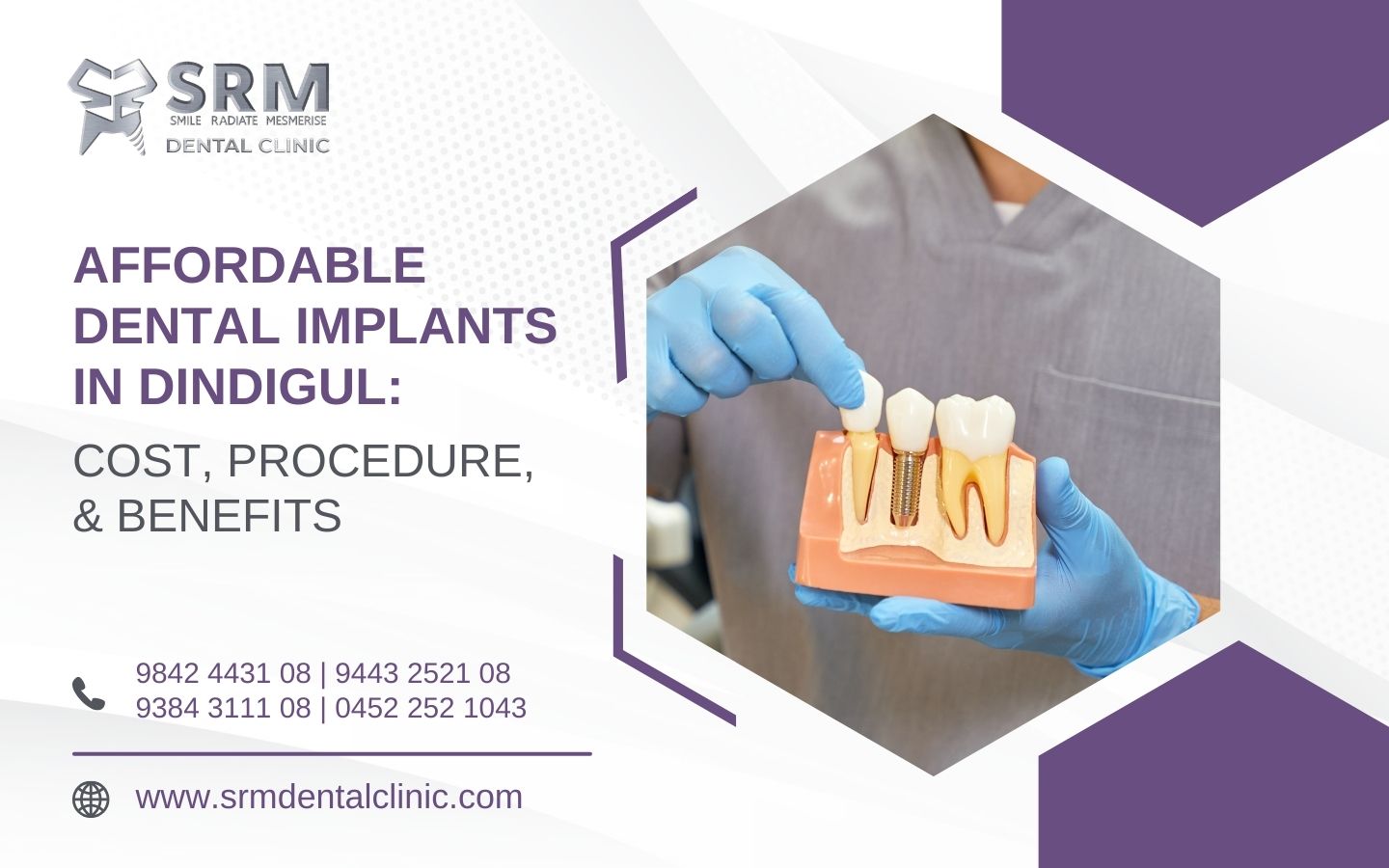Affordable Dental Implants in Dindigul