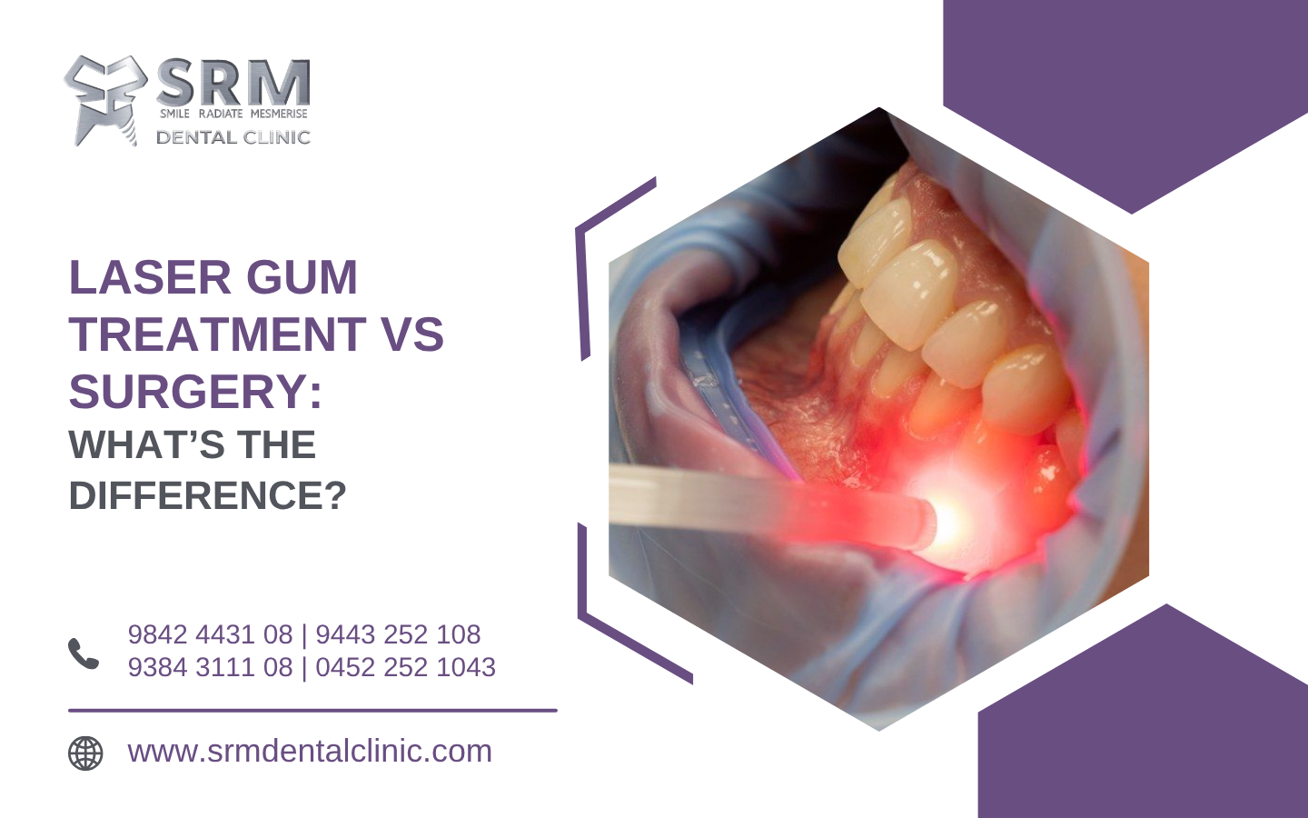 Laser Gum Treatment vs Surgery: What’s the Difference?