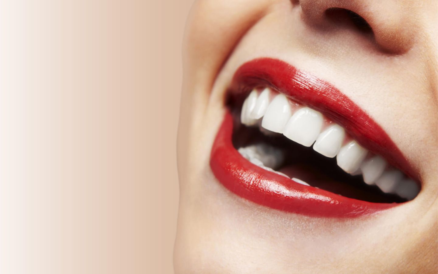 Teeth Whitening in Madurai