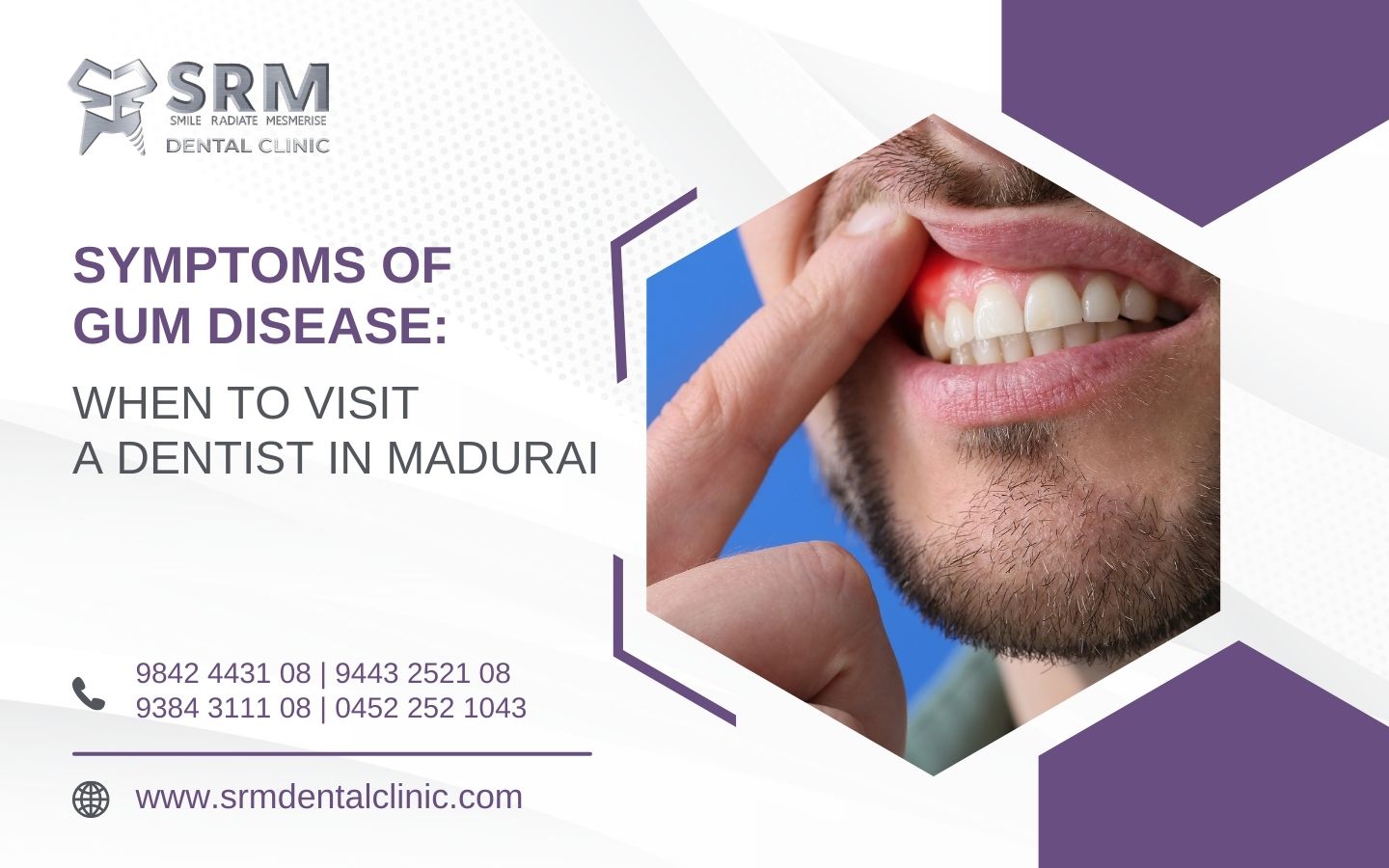 Gum Disease Dentist in Madurai